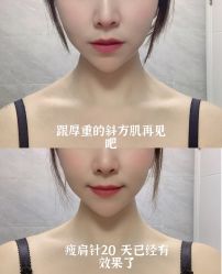 -上海漾颜医疗美容