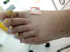 -新甲连锁灰指甲·甲沟炎·鸡眼(黑龙江路店)