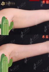 -贝黎诗SPA