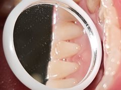 -思诺口腔(牛市口店)