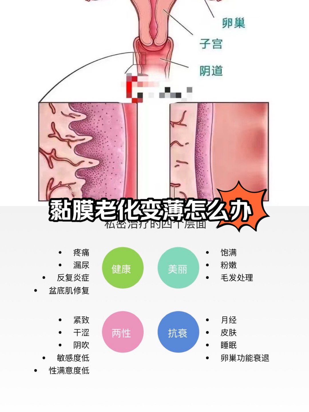 私密黏膜老化变薄怎么办