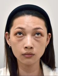 -天津健丽·去眼袋医疗美容机构