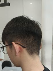 -天使之手