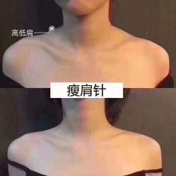 -上海漾颜医疗美容