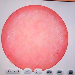 点击看大图 -宥莉·ULLY 痘敏肌•科技皮肤管理中心
