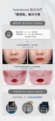 -安吉拉青春化管理中心
