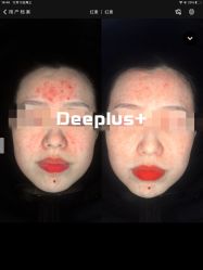 -Deeplus+韩国皮肤管理한국피부관리·C:Lab肌肤实验室