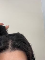 点击看大图 -润复丝·泽发防脱头皮管理