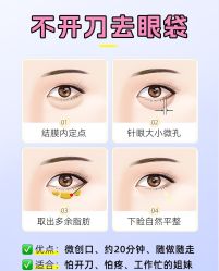 -广州健丽·去眼袋医疗美容机构