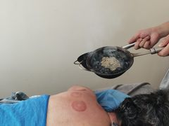 -张钰强中医正骨推拿连锁(唐家人才公寓店)