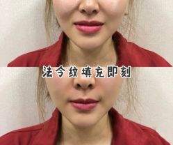 -上海漾颜医疗美容