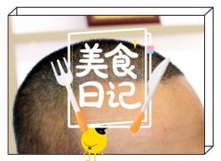 -大麦微针植发全国连锁