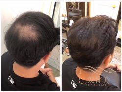 点击看大图 -发饰美男士增发补发假发定制店