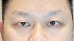 -德绣·机器野生眉发际线·美瞳线半永久