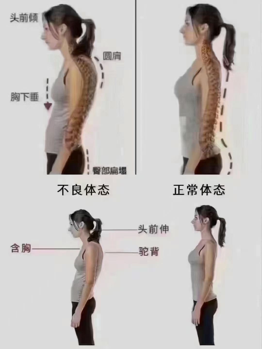 脊柱变形,五脏就会下垂