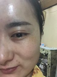 体验前-上海玫瑰医疗美容医院