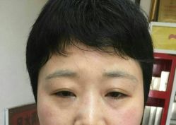 点击看大图 -北京美痣堂古方祛痣斑疣瘊