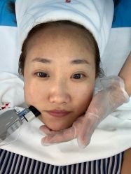 -靓芙泉祛痘.科技美肤连锁