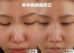 -北京米扬丽格医疗美容·联合丽格鼻整形中心