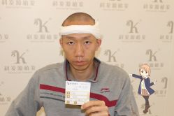 -大麦微针植发丨全国连锁