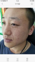 -百年美肤堂祛痦痣祛斑祛疣