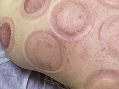 -沈师傅盲人按摩工作室(密三小区店)