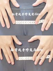 -梦斯绮私密催乳修复中心