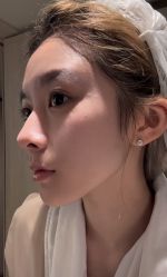 -韩辰医疗美容医院