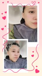 -希梵尔头皮抗衰·科技养发