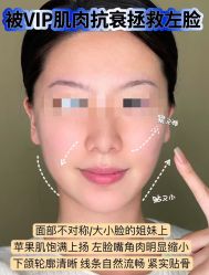 -安吉拉青春化管理中心