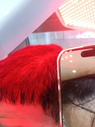 -碧莲盛·不剃发植发