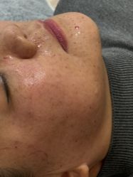 -长沙雅美医疗美容医院