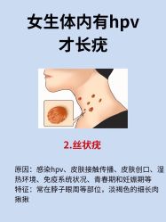-美丽人生祛斑扁平疣汗管瘤中心