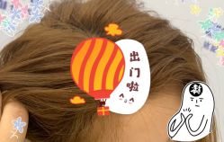 -大麦微针植发全国连锁