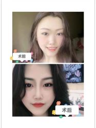 -广东韩妃整形外科医院