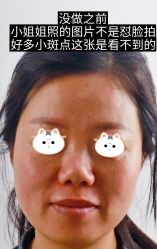 点击看大图 -苏州卫康美容医院