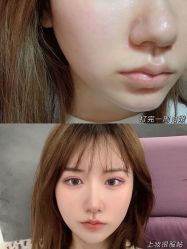 -大华韩艺整形美容医院