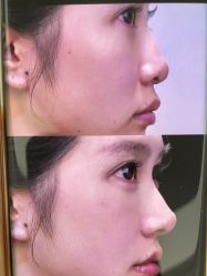 -东莞壹加壹整形美容医院