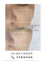 -E.beauty驻颜·痘敏肌调理中心