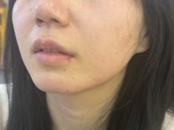 -长沙雅美医疗美容医院