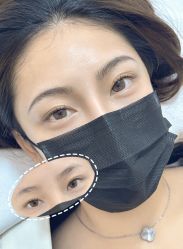 -杨益美学·野生眉半永久纹眉发际线