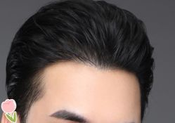 -大麦微针植发丨全国连锁