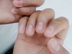 -新甲连锁灰指甲·甲沟炎·鸡眼(黑龙江路店)