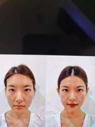 -Yestar重庆艺星医疗美容医院