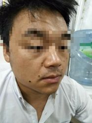 -北京美痣堂古方祛痣斑疣瘊