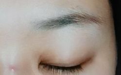 体验前-厦门美莱整形美容医院