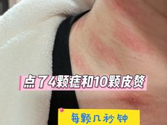 -杭州市第三人民医院