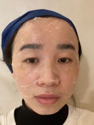 体验前-针美汇欧邦医疗美容