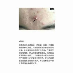 -美肤盾祛痘·问题肌头疗管理中心