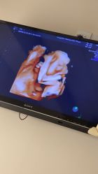 -杭州贝瑞斯美华妇儿医院·早孕·产检·儿科